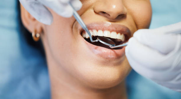 Best Emergency Tooth Extraction in Union, OR