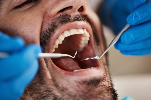 Best Emergency Treatment for Toothache in Union, OR