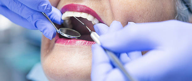 Best Emergency Treatment for Toothache in Union, OR